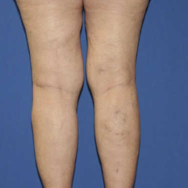 After Image