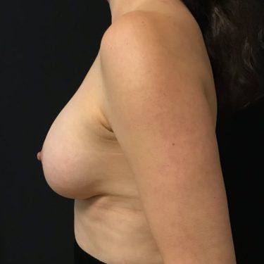 After Image