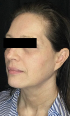After Image