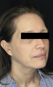 After Image