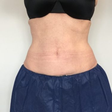After Image