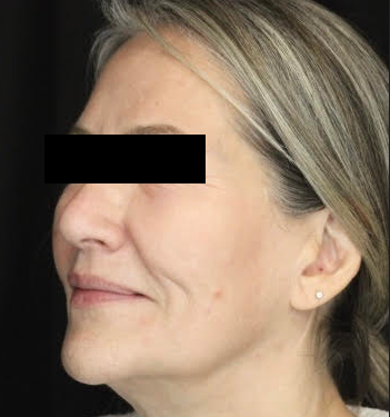 After Image