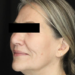 After Image