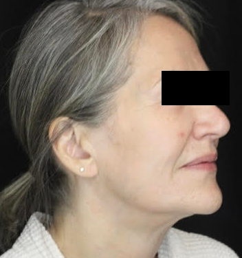 After Image